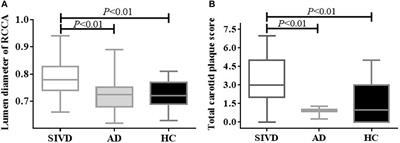 Cerebral Hemodynamics and Carotid Atherosclerosis in Patients With Subcortical Ischemic Vascular Dementia